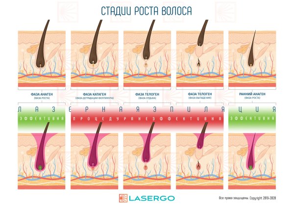 Фазы роста волос и лазерная эпиляция