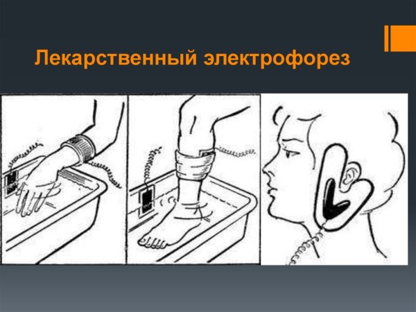 Электрофорез 2у101г