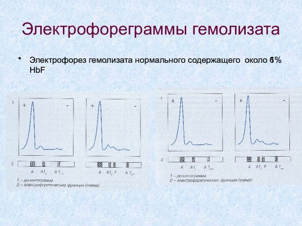 Электрофорез лекарственных веществ