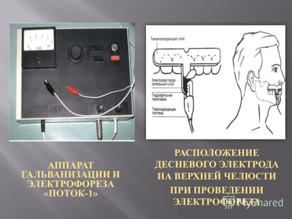 Электрофорез схема прибора Элфор