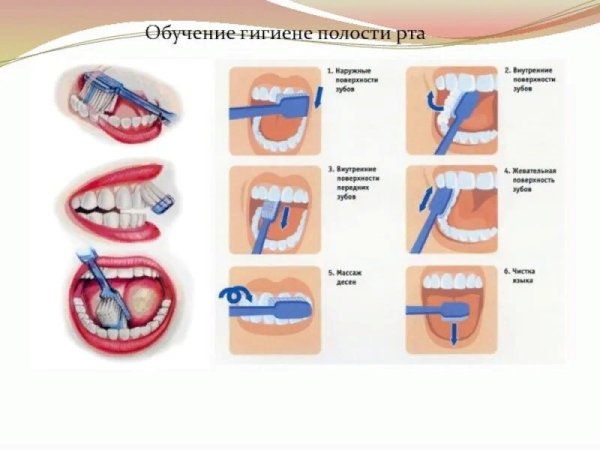 Памятка по гигиене полости рта