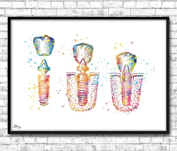 Постеры в стоматологию