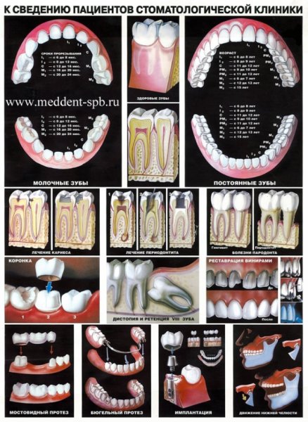 Плакаты по ортопедической стоматологии