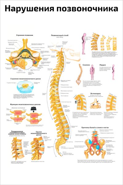 Позвоночник плакат