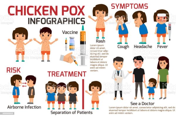 Ветрянка санбюллетень