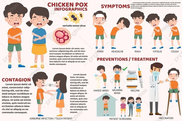 Профилактика ветряной оспы у детей в детском саду