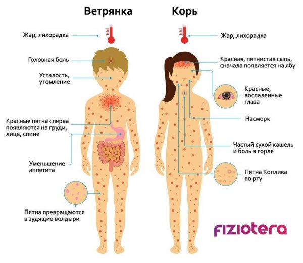 Способы передачи ветряной оспы