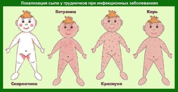 Краснуха на теле у взрослых