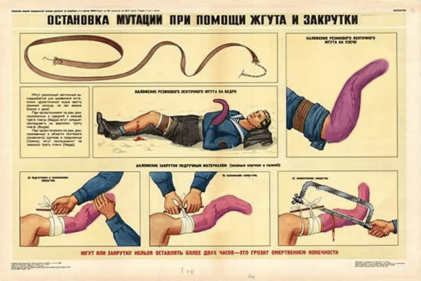 Остановка кровотечения плакат