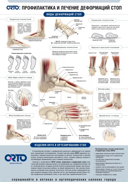 Схема костей стопы человека сбоку