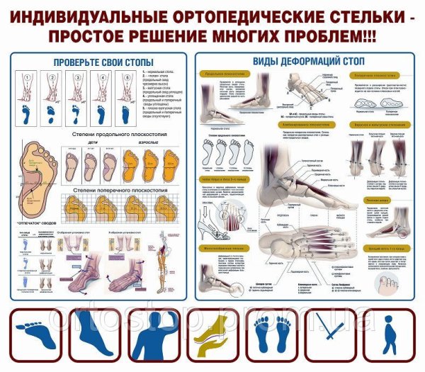 Стопа анатомия