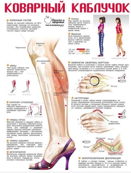 Рефлекторные зоны стопы схема
