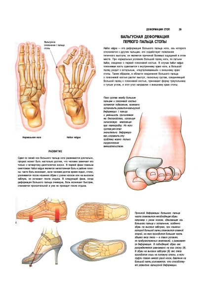 Плакат анатомия стопы