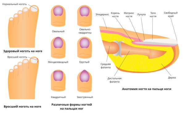 Поперечное плоскостопие отпечаток