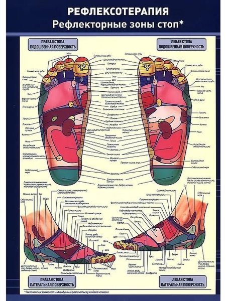 Поперечное плоскостопие симптомы стельки
