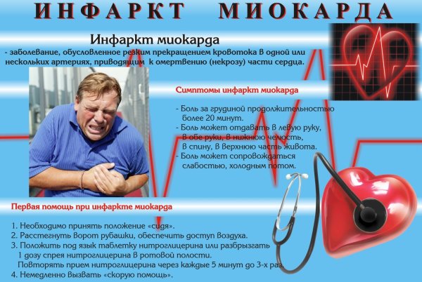 Симптомы ИБС инфаркт миокарда