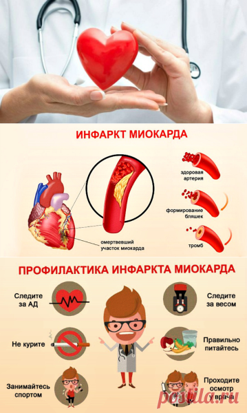 Инфаркт м̾и̾о̾к̾а̾р̾д̾а̾ профилактика