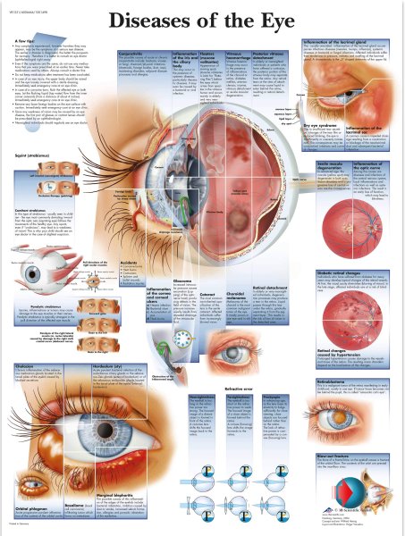 Анатомия глаза плакат