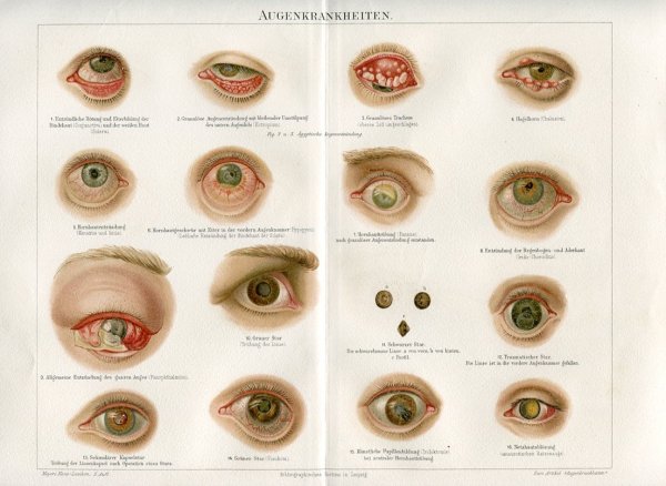 Глаз плакат