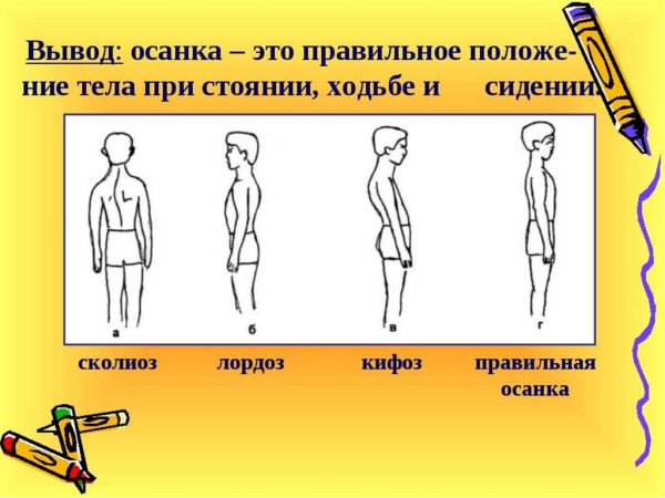 Сиди правильно. Плакат