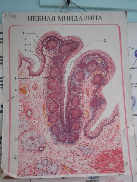 Небная миндалина гистоло