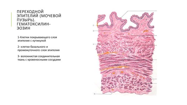 Переходный эпителий мочевого пузыря гистология препарат