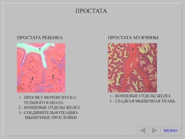 Предстательная железа гистология препарат