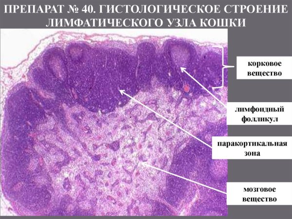 Лимфатический узел гистология препарат