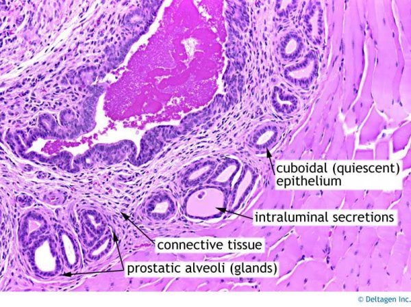 Гистологический препарат предстательной железы