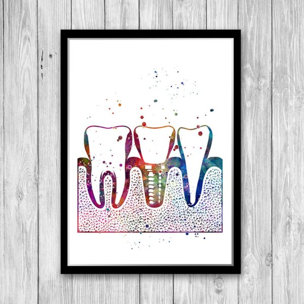 Постеры зубов в стоматологию