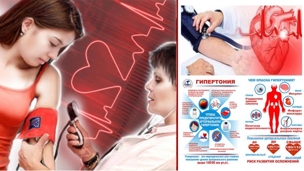 Профилактика осложнений гипертонической болезни