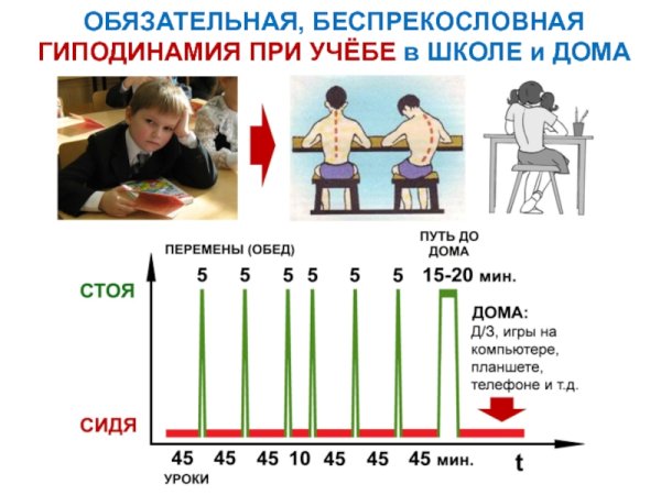 Гиподинамия возникает в результате