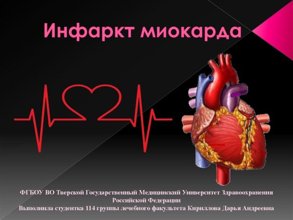Инфаркт миокарда макро