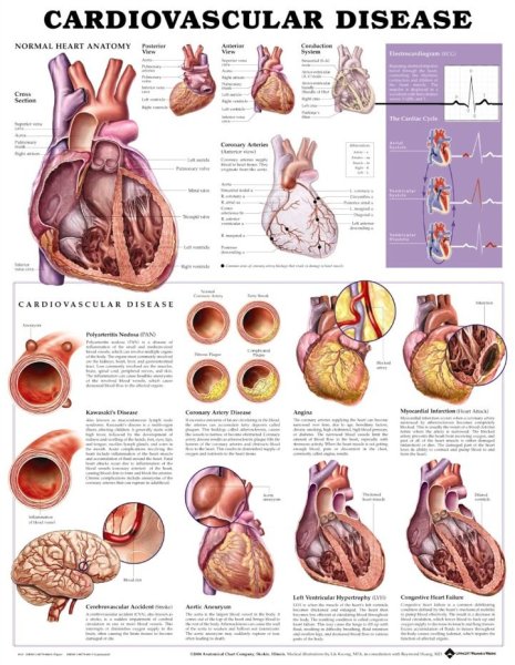Памятка для снижения холестерина