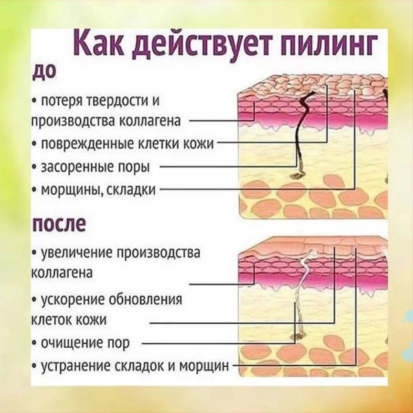Кожа и ее слои плакат