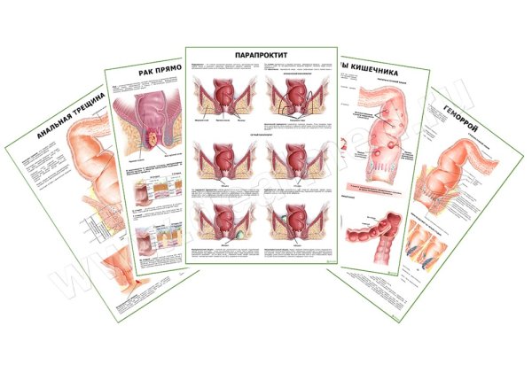 Плакат массаж рекламный