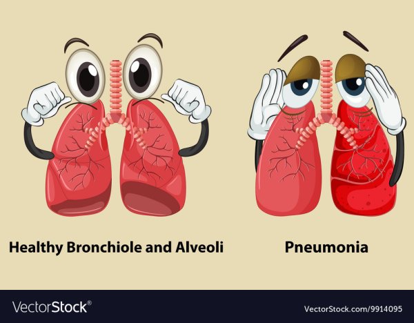 Профилактика пневмонии буклет