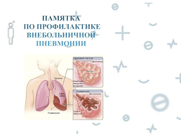 Памятка пневмококковая инфекция