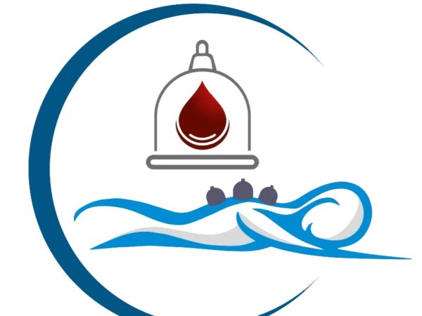 Хиджама банки вектор