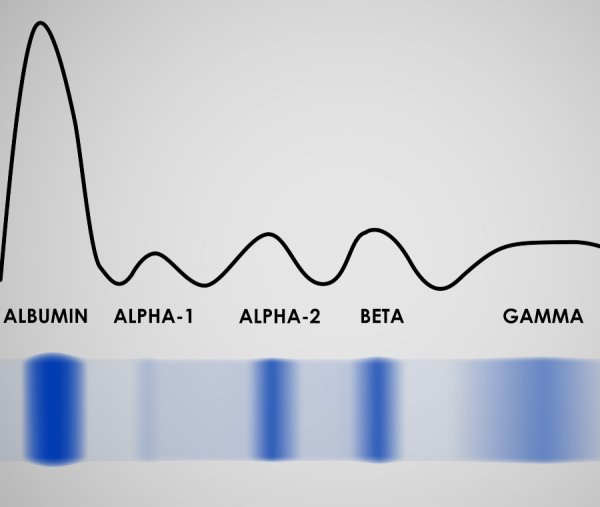 Электрофорез лечение