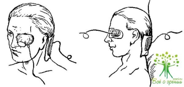 Электрофорез лекарственных веществ