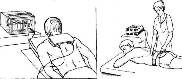 Лекарственный электрофорез биофизика