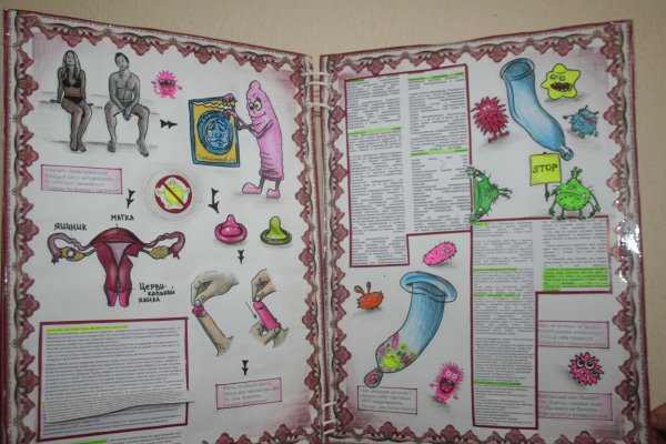 Плакат методы контрацептивов