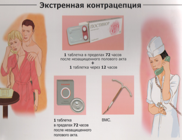 Современные методы контрацепции