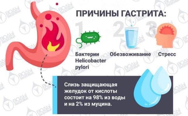 Гастрит памятка