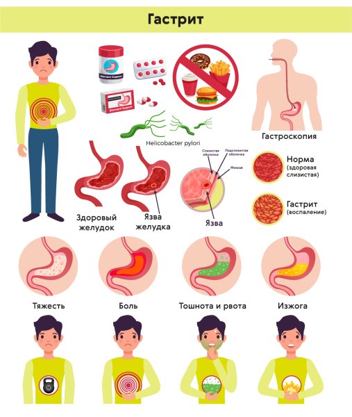 Факторы риска острого гастрита