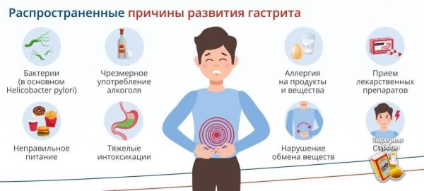 Памятка для пациента с язвенной болезнью желудка питания