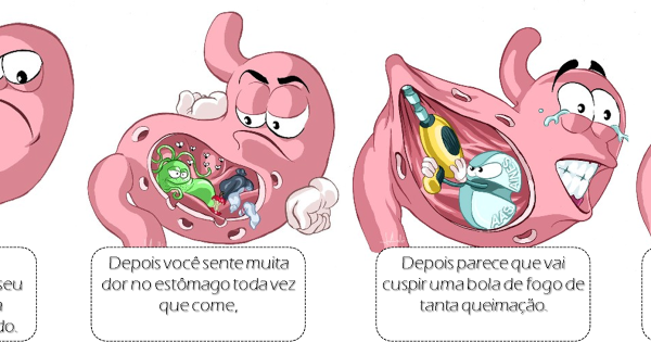 Гастрит памятка