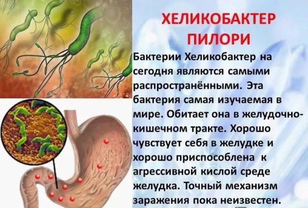 Терапия язвенной болезни 12 перстной кишки