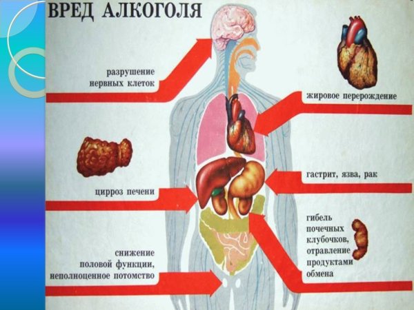 Вредные привычки алкоголь презентация